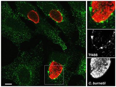 High-Content Imaging Reveals Expansion of the Endosomal Compartment during Coxiella burnetii Parasitophorous Vacuole Maturation